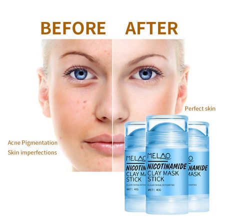 https://img.bestdeals.co.nz/products_pictures/377/37722_329634_F.jpg