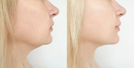 https://img.bestdeals.co.nz/products_pictures/395/39545_349579_F.jpg