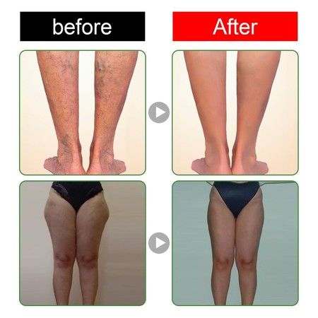https://img.bestdeals.co.nz/products_pictures/487/48749_452133_F.jpg