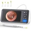 Digital Otoscope with 4.5 Inch Screen,3.9mm Ear Camera with 6 LED Lights,32GB Card,Ear Wax Removal Tool,Specula and 2500 mAh Battery