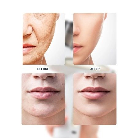https://img.bestdeals.co.nz/products_pictures/593/59311_553193_F.jpg
