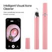 Smart Visual Blackhead Remover Acne Needle Cleansing Cosmetic Devices Acne Squeeze Pore Cleaner Facial Treatment With Camera Color Pink