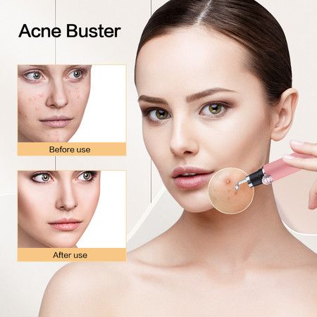 https://img.bestdeals.co.nz/products_pictures/630/63074_593785_F.jpg