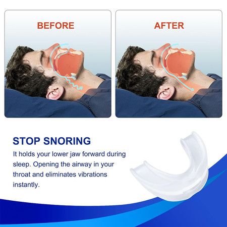 https://img.bestdeals.co.nz/products_pictures/694/69443_662216_F.jpg