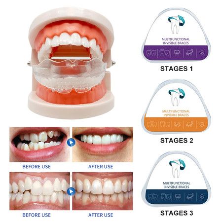 https://img.bestdeals.co.nz/products_pictures/694/69460_662374_F.jpg