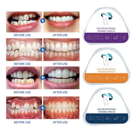 https://img.bestdeals.co.nz/products_pictures/694/69460_662376_F.jpg