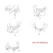 Hernia Belt Truss Hernia Band Inguinal for Men, Left Or Right Side Adjustable Waist Strap for Men and Woman Hernia Guard Inguinal Truss,White