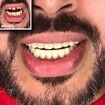 Instant Smile Comfort Fit Flex Teeth - Upper and Lower Matching Set, Natural Shade! Fix Your Smile at Home Within Minutes