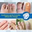 Nail Fungus Cleaning Device,Nail Fungus for Damaged Discolored Thick Toenails Fingernails,Effective Rechargeable Nail Fungus Remover for Home Use