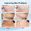 Neck Face Massager, Multifunctional Facial Massager, Rechargeable Sculpting Tool for Skin Care and Double Chin with Vibration(Black)