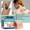 2 Boxes Scar Tattoo Cover Up Tape Sheets, Invisible Skin Tone Concealer Tattoo Stickers Cover Up Scars Patch Waterproof, 5cm x 5cm x 500 cm