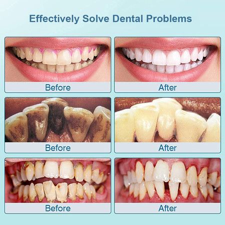https://img.bestdeals.co.nz/products_pictures/810/81068_774470_F.jpg