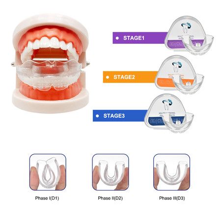 https://img.bestdeals.co.nz/products_pictures/817/81769_798652_F.jpg