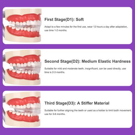 https://img.bestdeals.co.nz/products_pictures/817/81769_798653_F.jpg