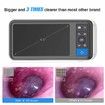Advanced Digital Otoscope with High-Definition Screen,3.9mm Ear Camera,6 LED Lights,Ear Wax Removal Tool,Rechargeable Battery for Comprehensive ear inspection