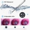 Advanced Digital Otoscope with High-Definition Screen,3.9mm Ear Camera,6 LED Lights,Ear Wax Removal Tool,Rechargeable Battery for Comprehensive ear inspection