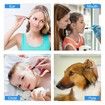 Advanced Digital Otoscope with High-Definition Screen,3.9mm Ear Camera,6 LED Lights,Ear Wax Removal Tool,Rechargeable Battery for Comprehensive ear inspection