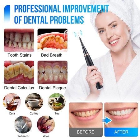 https://img.bestdeals.co.nz/products_pictures/822/82265_801089_F.jpg