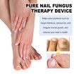 Nail Device Nail Fungus Cleaning Device Nail Fungus for Damaged Discolored Thick Toenails Fingernails