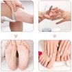 Electric Callus Remover,Pedicure Foot Care and Manicure Callus Rasp,USB Rechargeable Callus Remover with 5 Replacement Rollers