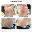 2in1 Rechargeable Electric Callus Remover for Feet Pedicure Manicure Tool Cordless USB Foot File Kit with Sandpaper Discs(Pink)